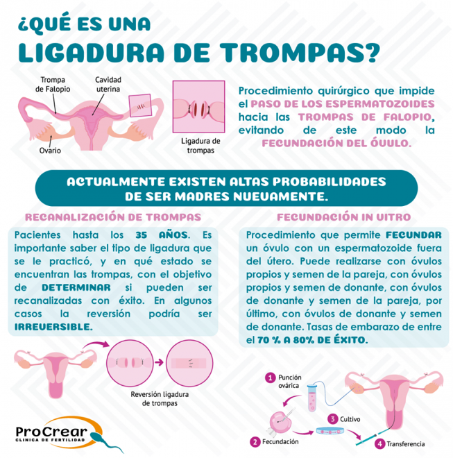 El sueño de volver a ser madre tras una ligadura de trompas si es